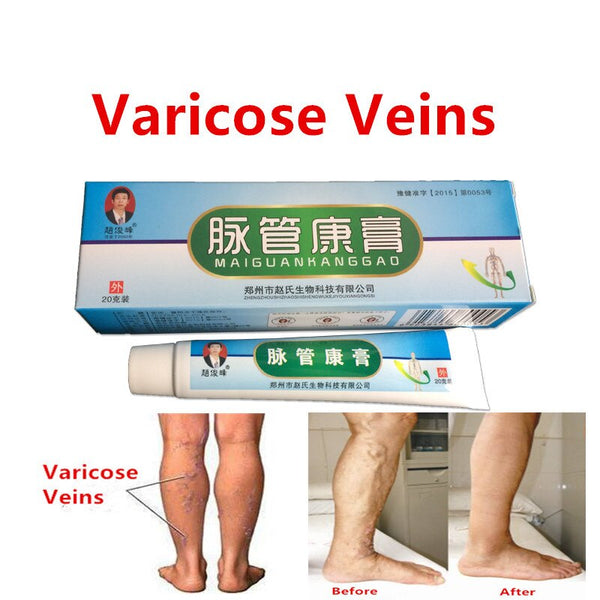 1pcs Varicose Veins Treatment Ointment Vasculitis Phlebitis Spider Veins Pain Varicosity Angiitis Remedy Removal Herbal Cream