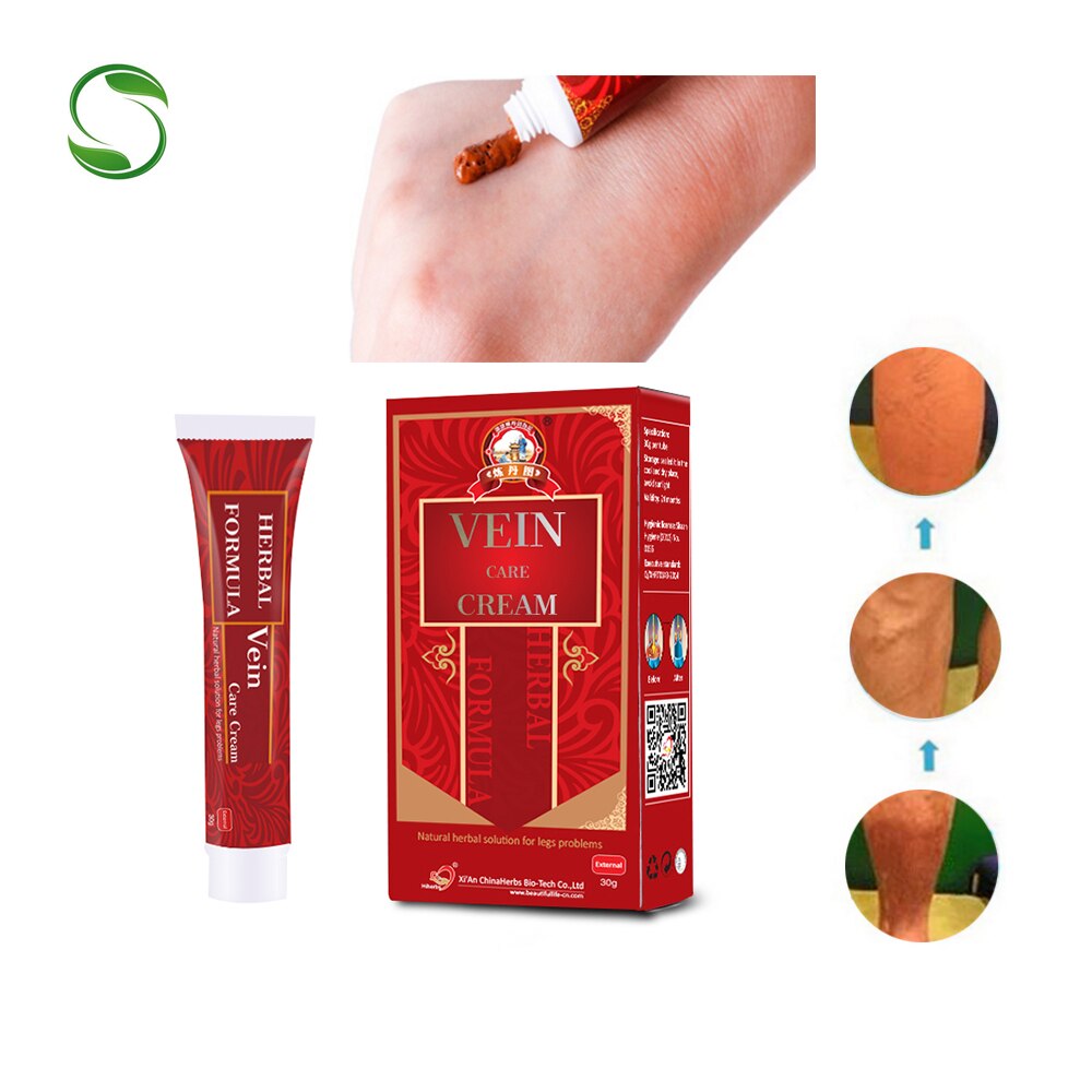 5 box Varicose Veins Treatment Cream Vasculitis Phlebitis Spider Veins Pain Varicosity Angiitis Remedy Removal Herbal Cream